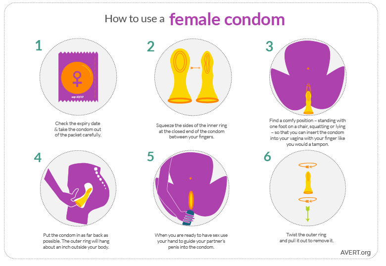 Как правильно пользоваться презертивами видео Инструкция по надеванию презерватива Всё о 1279